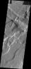 PIA07812: Compounded Fractures