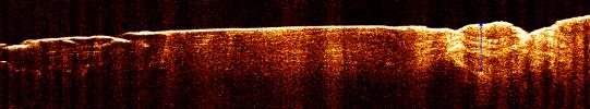PIA09095: Radar View of Layering near Mars' South Pole, Orbit 1360