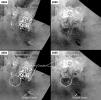 PIA11147: Changes in Titan's Lakes